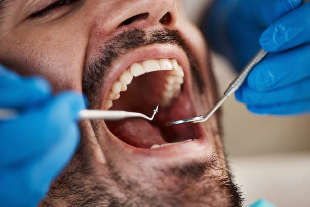 Best Urgent Care for Lost Fillings or Crowns in Colchester, IL