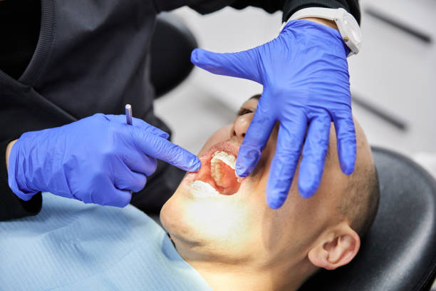Best Emergency Dental Care for Broken or Chipped Teeth in Colchester, IL