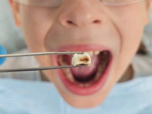 Best Emergency Denture Repair in Colchester, IL